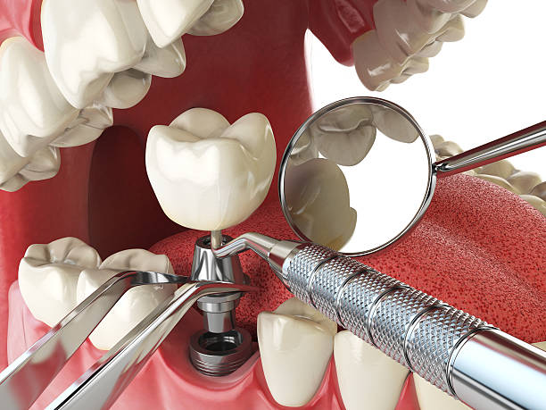 Best Emergency Gum Pain Relief  in Mount Pleasant, TX